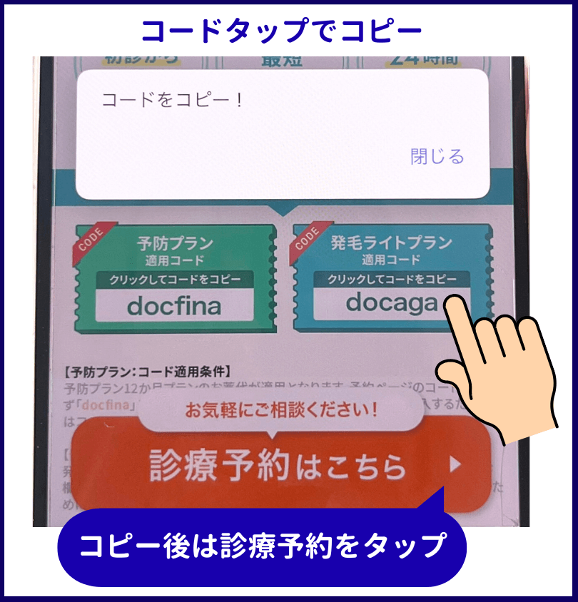 DMMオンラインクリニックAGA治療のクーポンコードを示した画像
