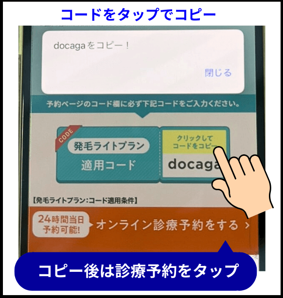 DMMオンラインクリニックAGA治療のクーポンコードを示した画像
