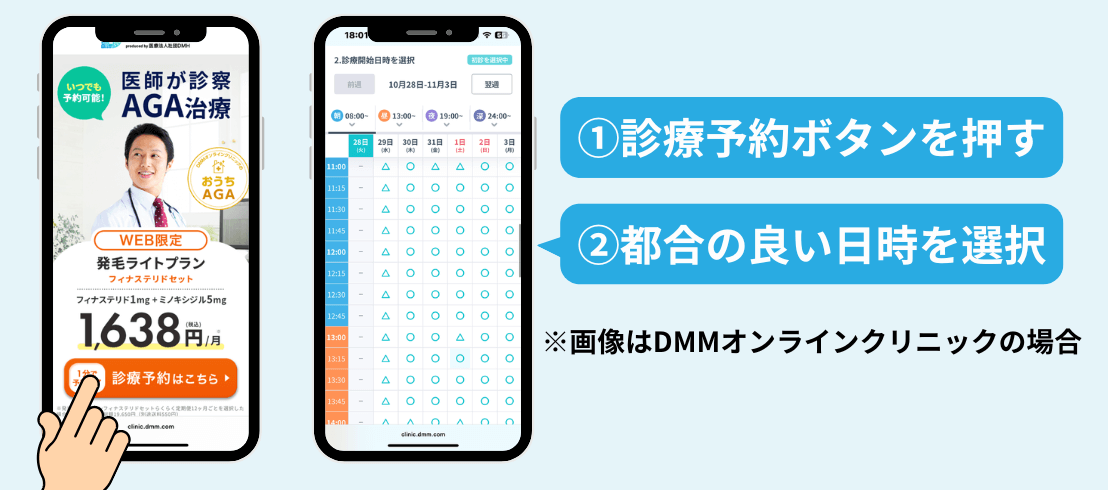 AGAオンライン診療の予約イメージ