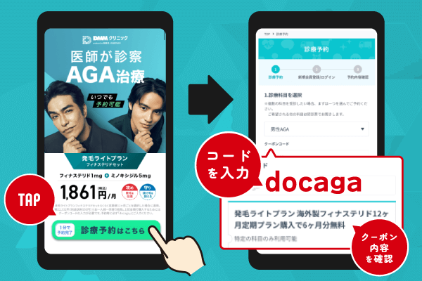 DMMオンラインクリニックAGA治療のクーポンコードを示した画像